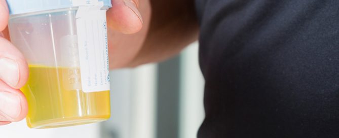Diagnostik 24 Stunden Sammelurin