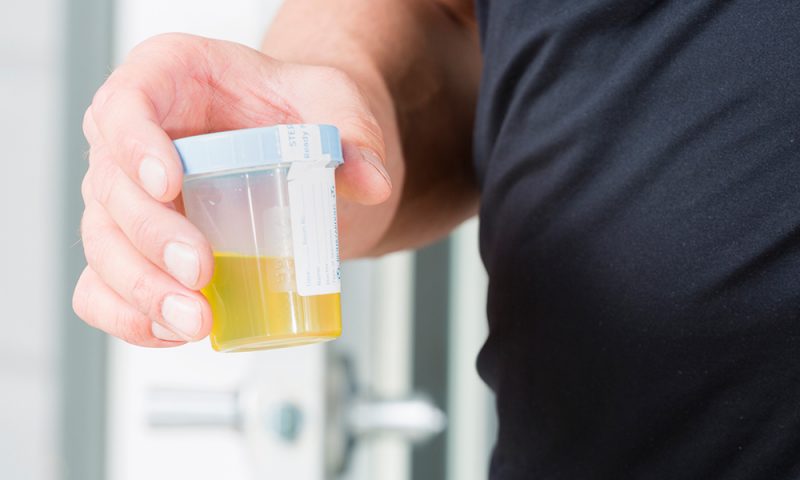 24 Stunden Sammelurin Was Beachten www.naturheilkunde-ratgeber.de