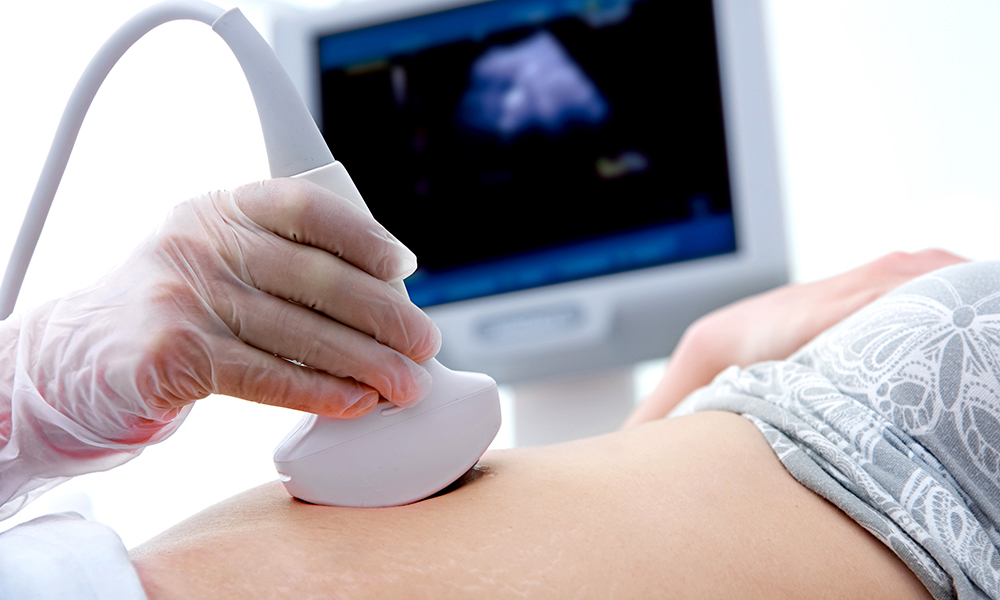 Untersuchungsmethode Ultraschall bei einer jungen Frau